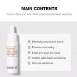 Skinever Salicylic Acid Anti Acne Serum